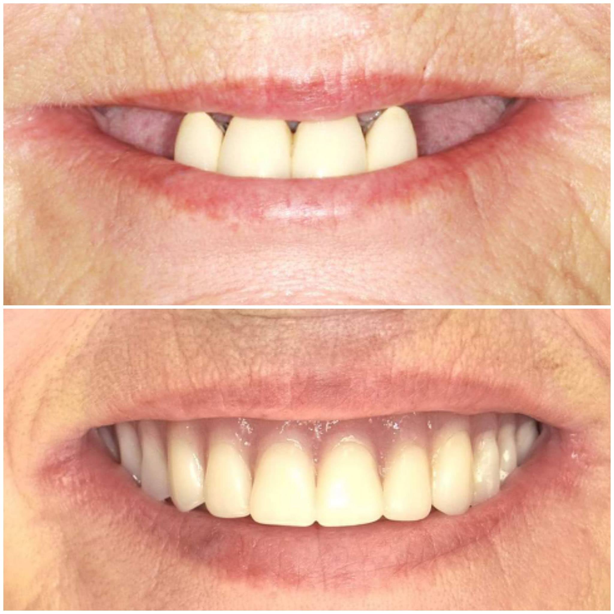 Charles Hawkins, DDS Mini Dental Implant Centers of America MDICA