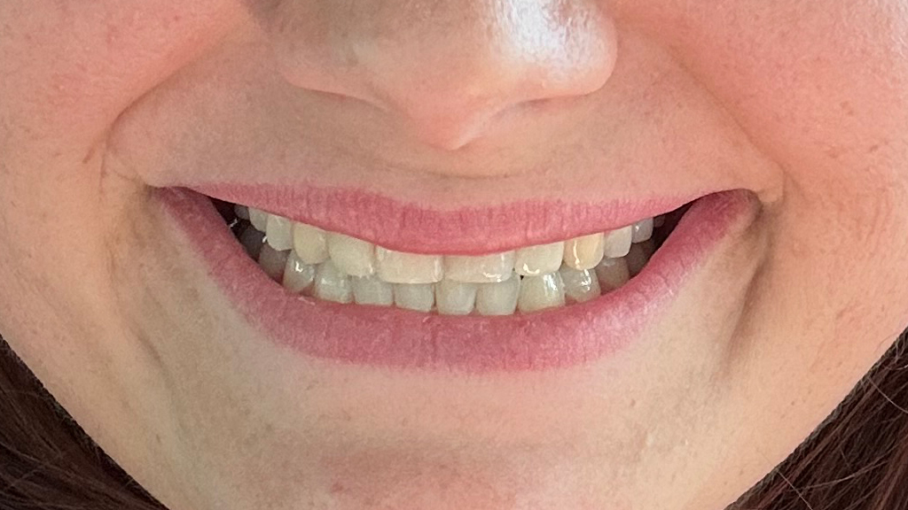 before image