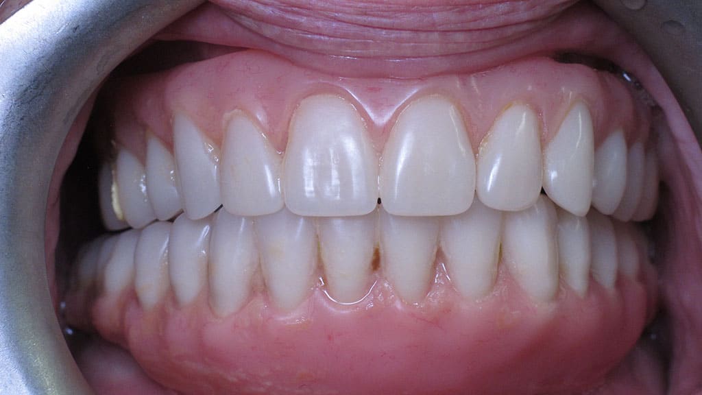 before image
