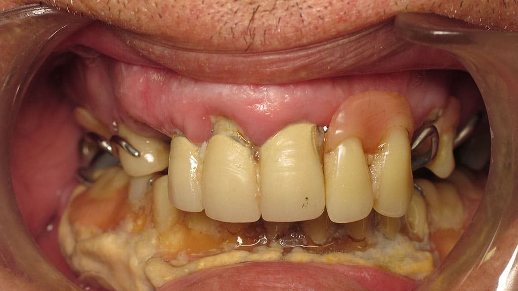 before image