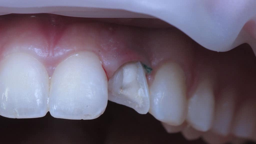 before image