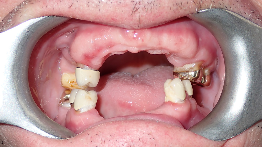 before image