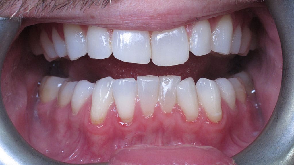 before image