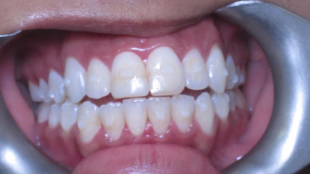 before image
