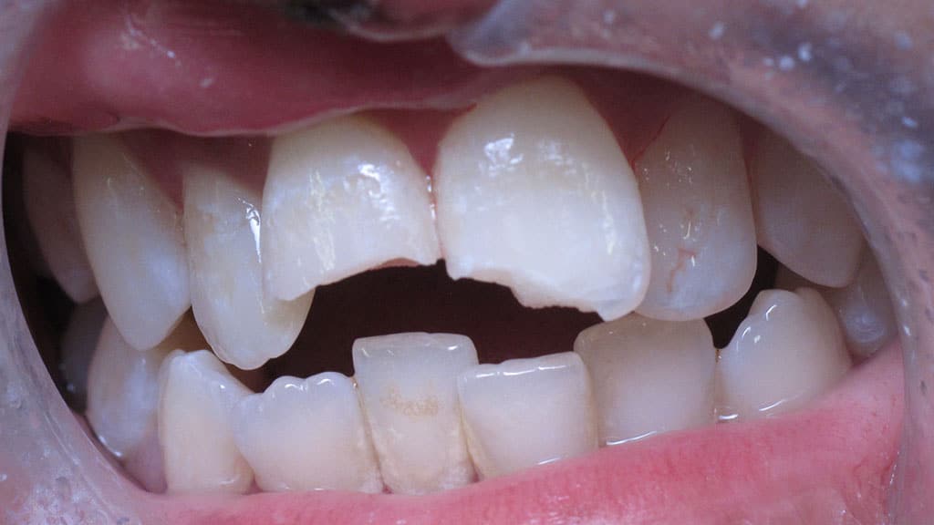 before image