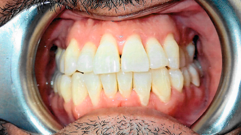 before image