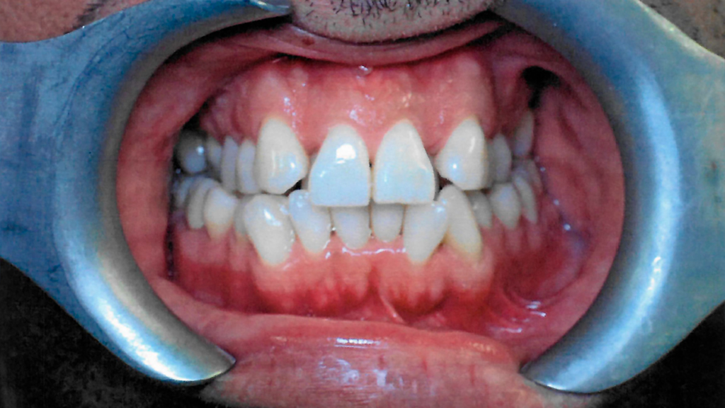 before image
