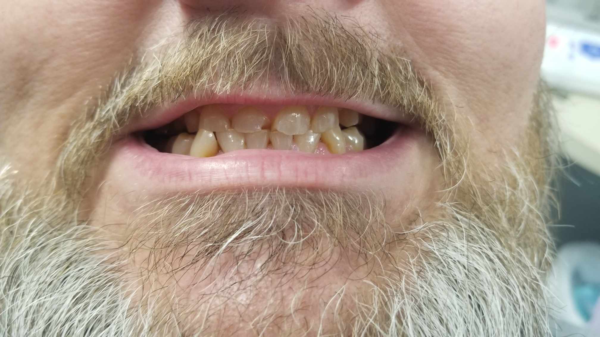 before image