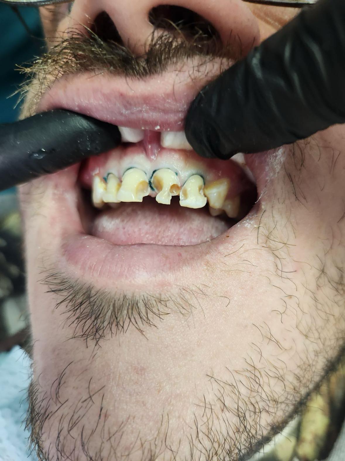 before image