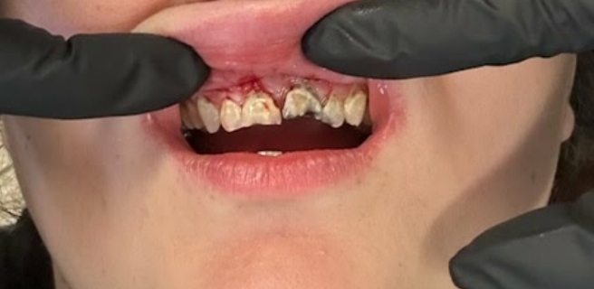 before image