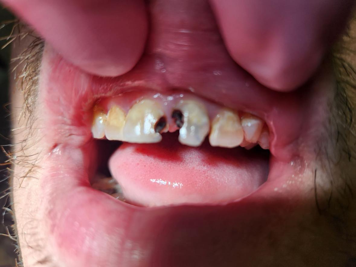 before image