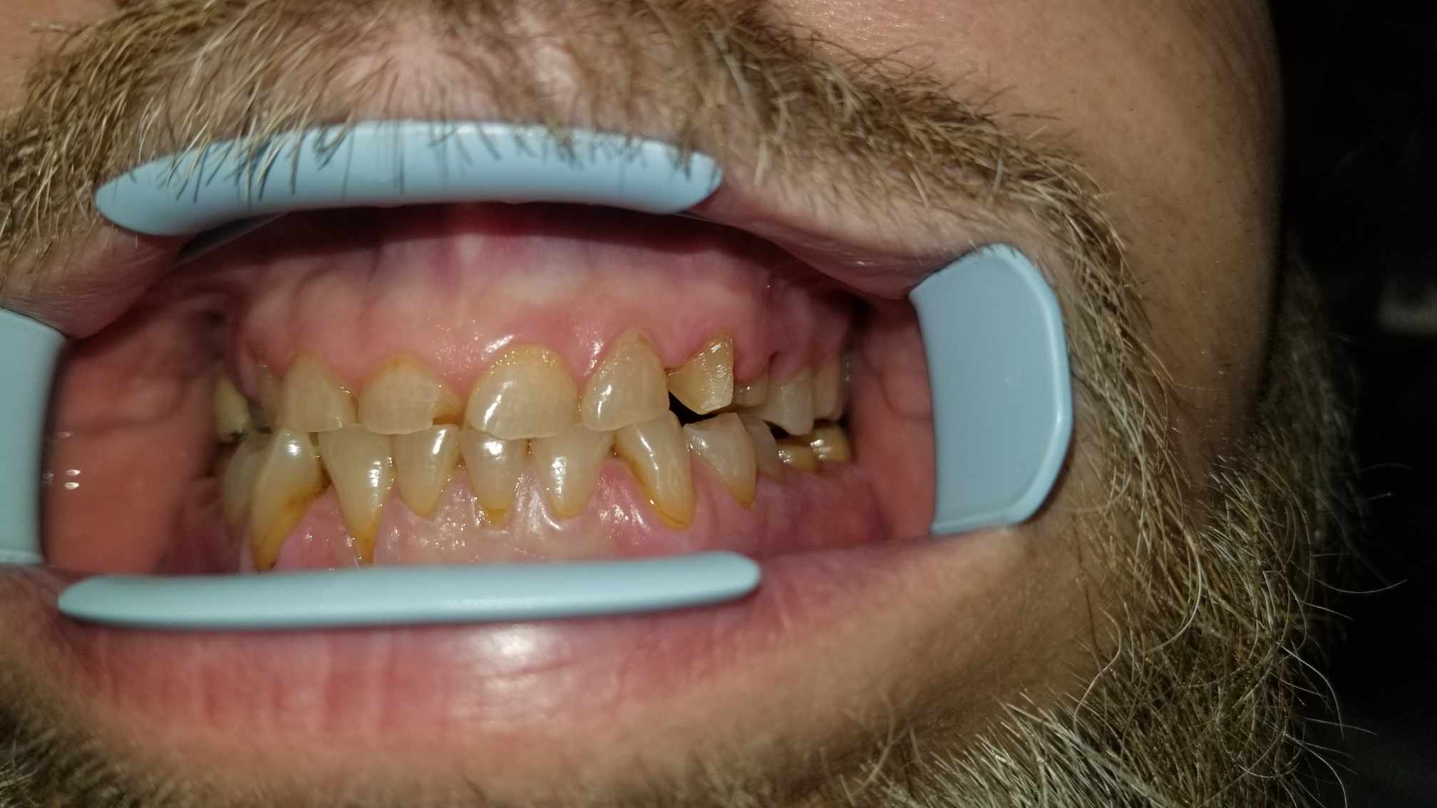 before image