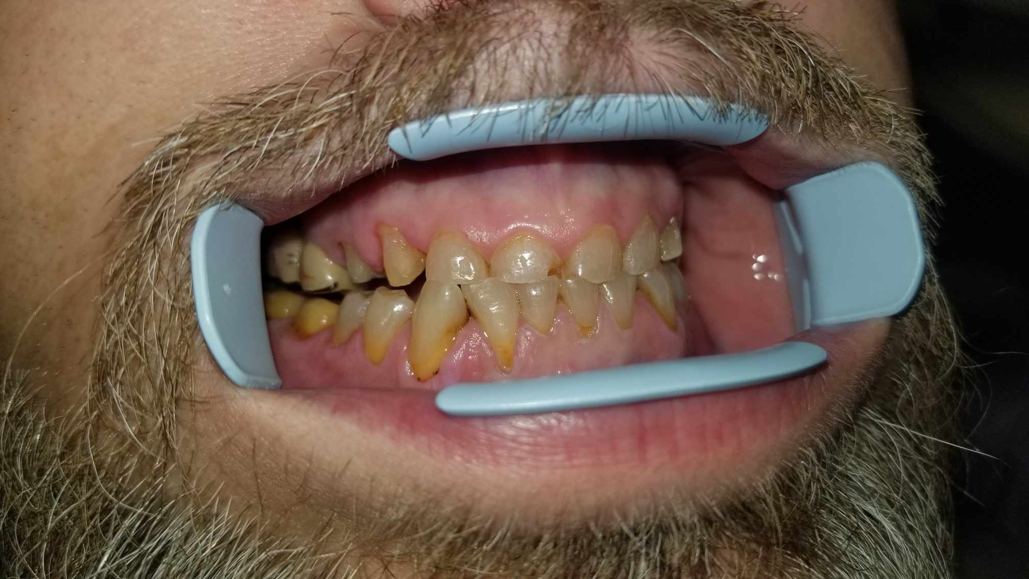 before image
