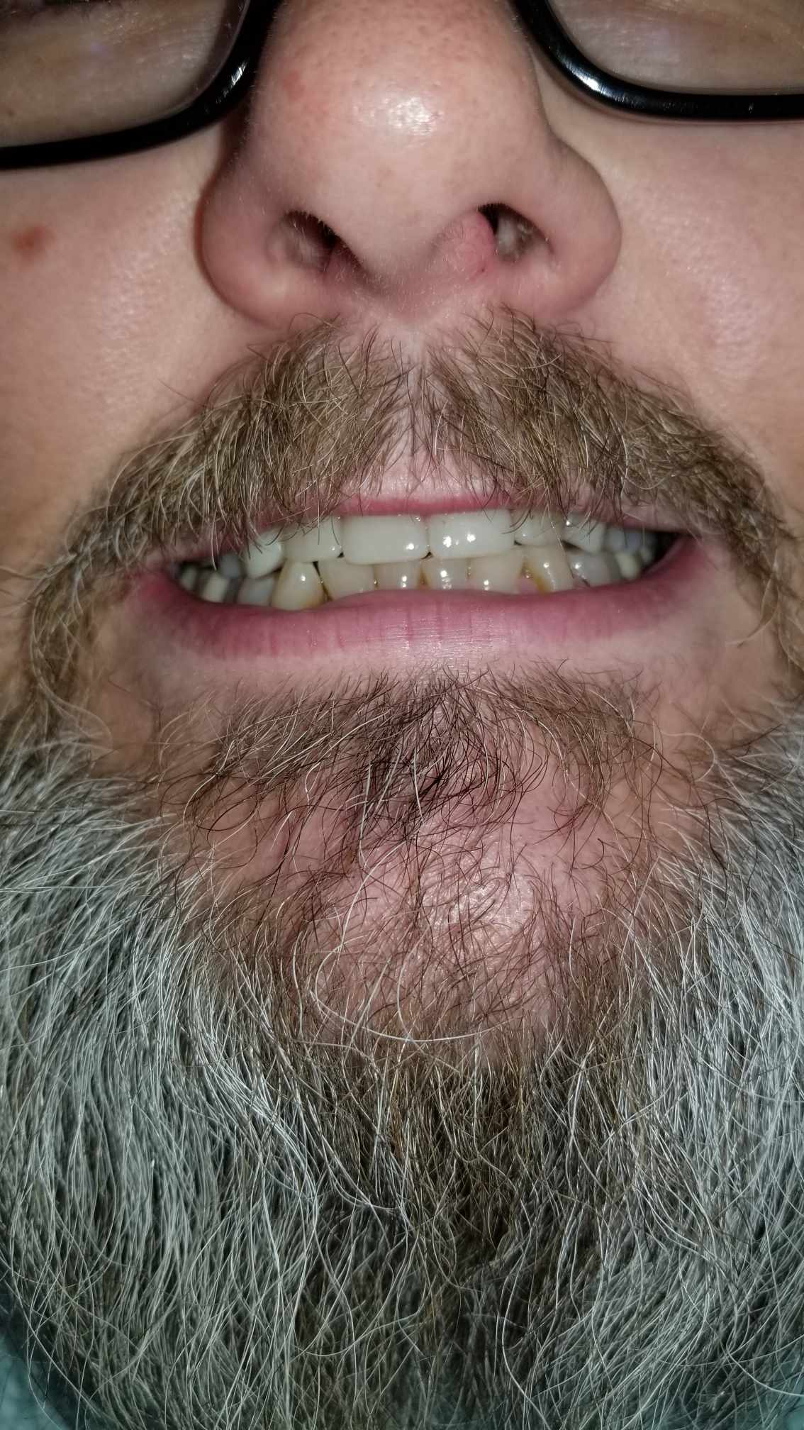 before image